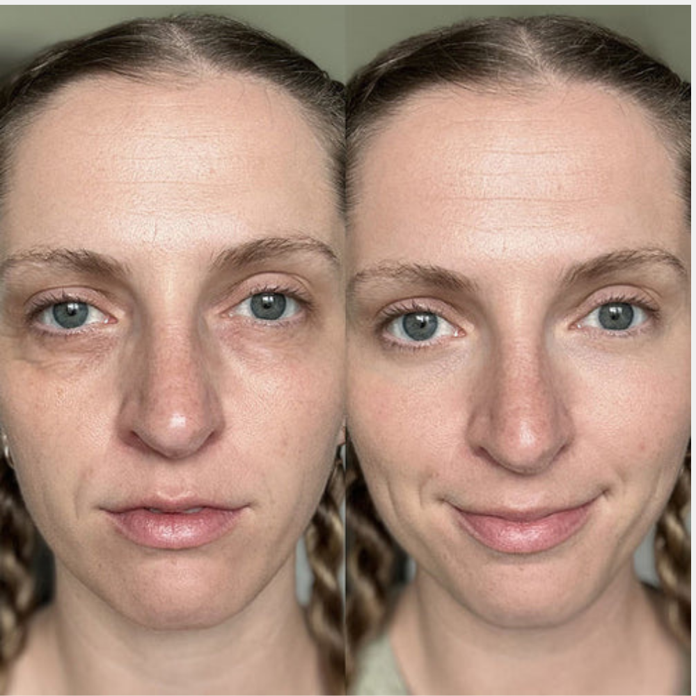 Klivora Under Eye Balm