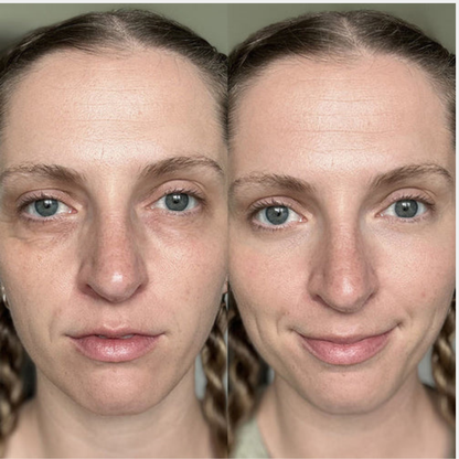 Klivora Under Eye Balm