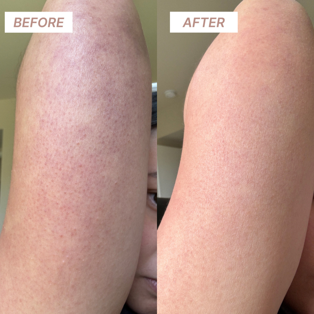KP Clearing Exfoliating  Wash Towel