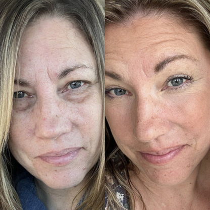 Klivora Under Eye Balm