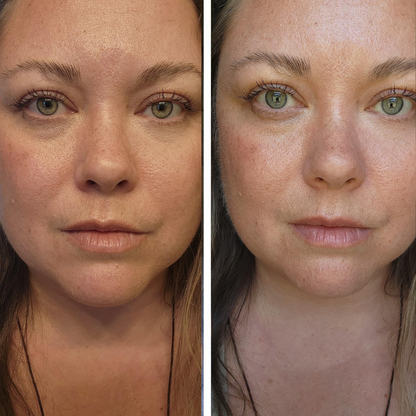 Volufiline Deep Collagen Power Serum